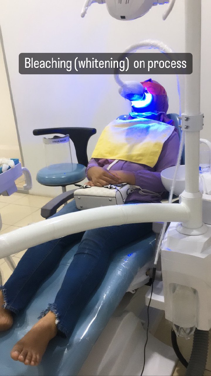 Bleaching 4