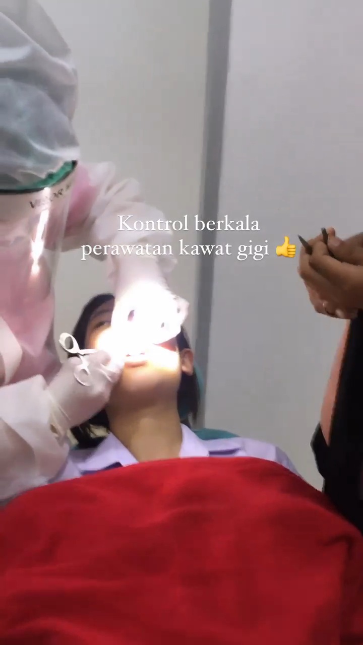 Kawat Gigi 28